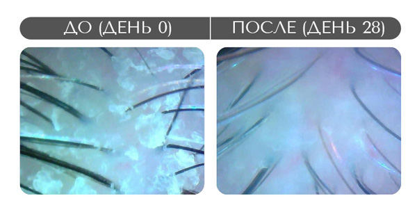 результаты за 28 дней